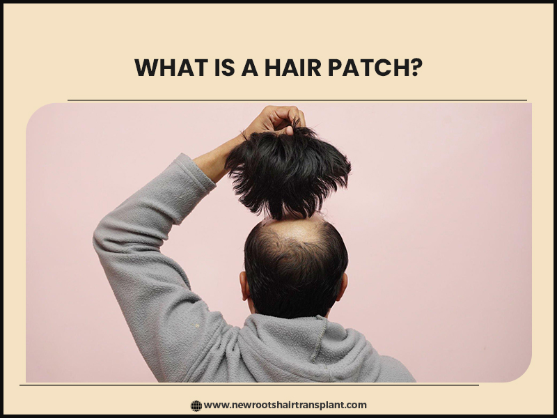 What is a hair patch