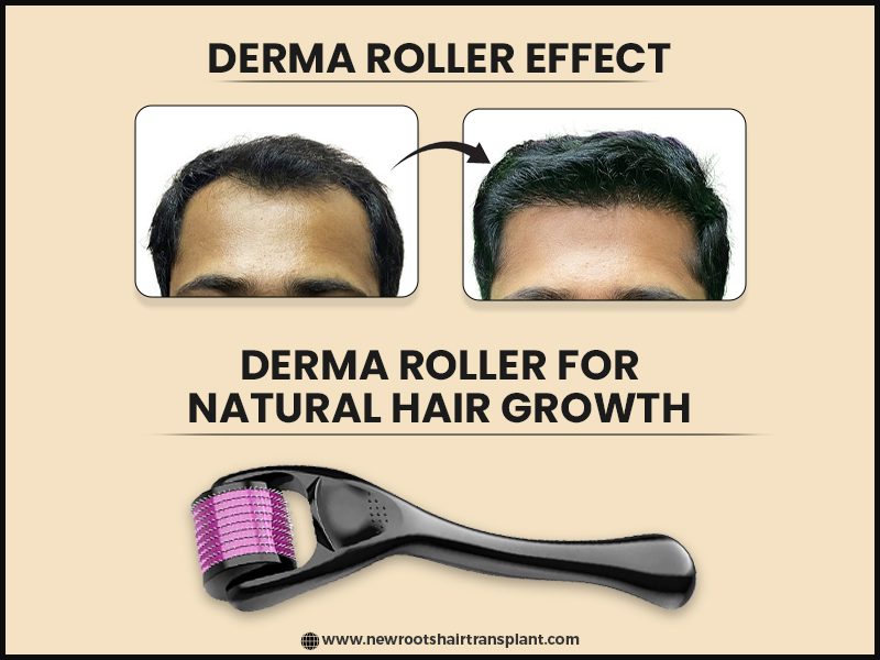 8 Benefits of Using Derma Roller for Hair Growth (Must Try) (2023)