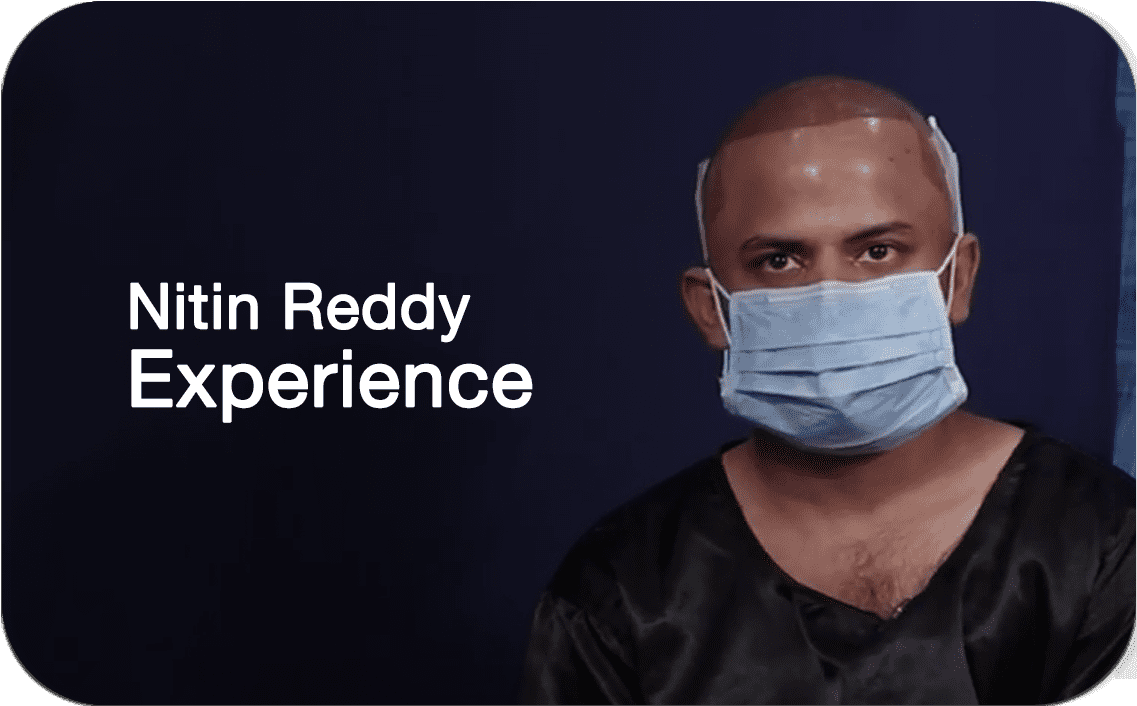 Best Hair Transplant in Hyderabad - Permanent Hair Restoration Best Hair Transplant in Hyderabad - Permanent Hair Restoration