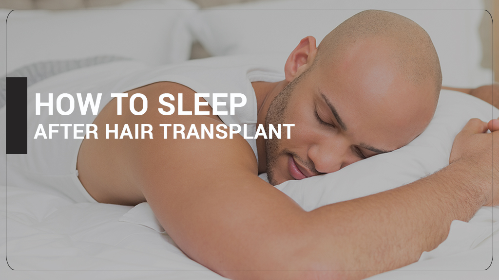 HOW TO SLEEP AFTER HAIR TRANSPLANT