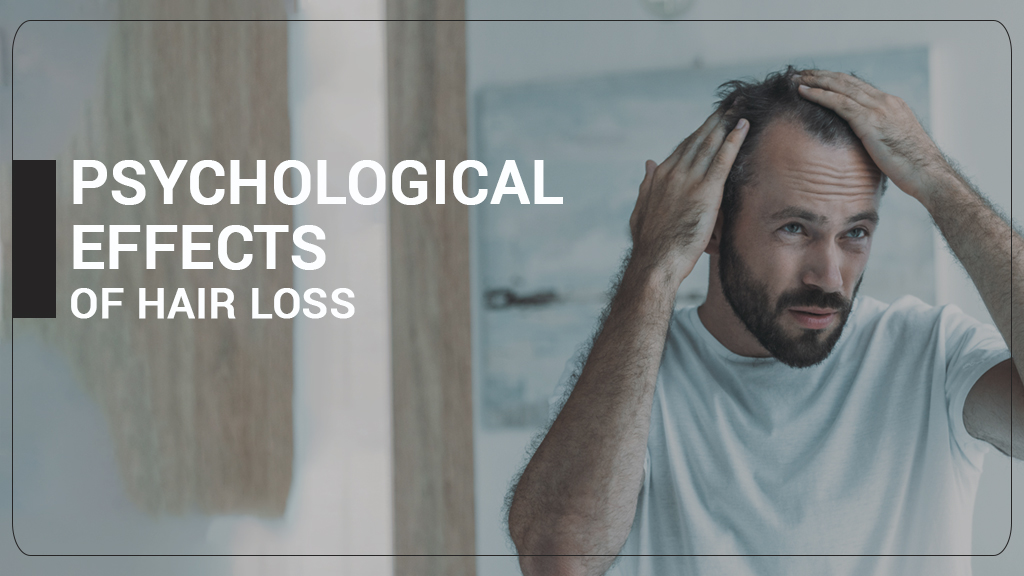 PSYCHOLOGICAL EFFECTS OF HAIR LOSS