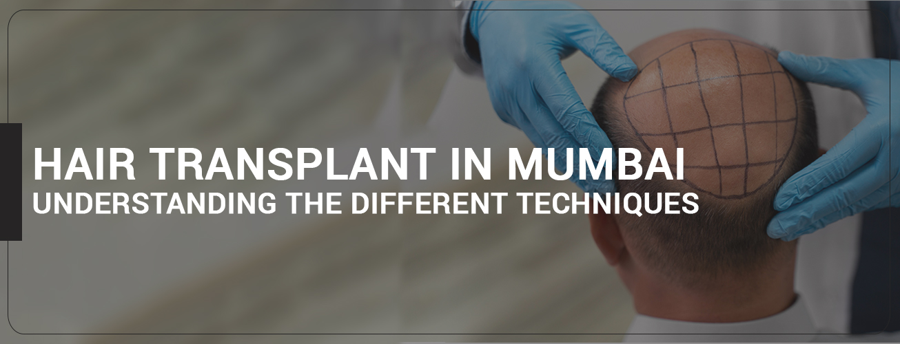 Hair Transplant in Mumbai: Understanding the Different Techniques