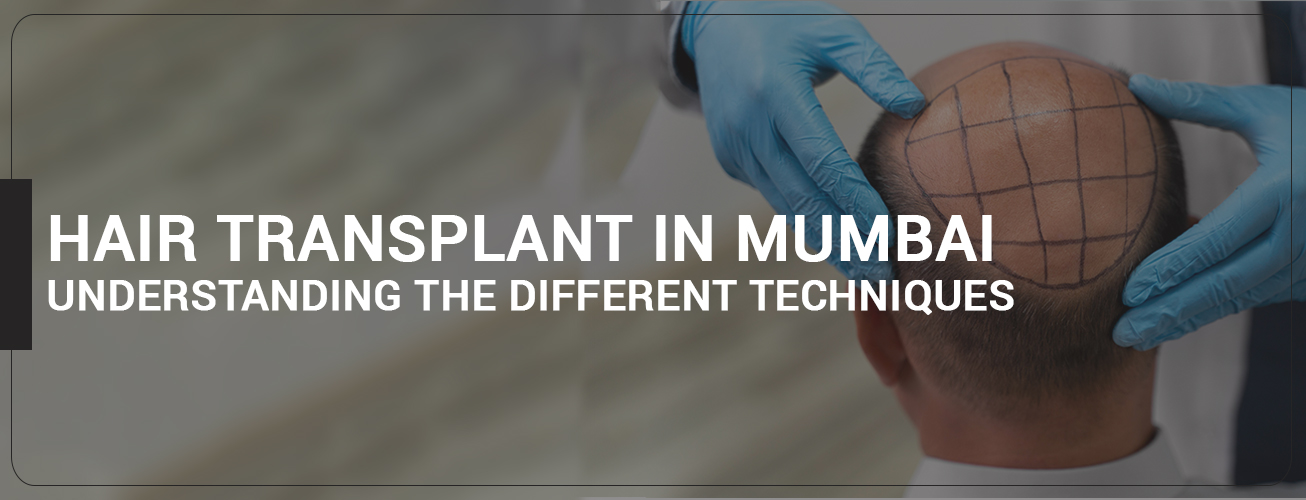 Hair Transplant in Mumbai: Understanding the Different Techniques Hair Transplant in Mumbai: Understanding the Different Techniques
