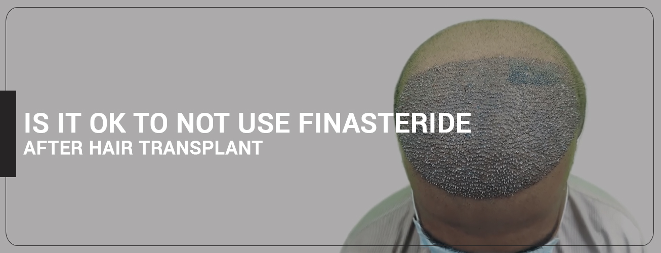 IS IT OK TO NOT USE FINASTERIDE AFTER HAIR TRANSPLANT ?
