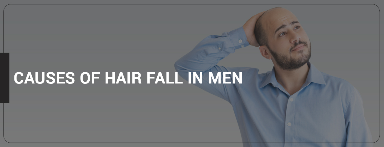 10 Causes of Hair fall in Men