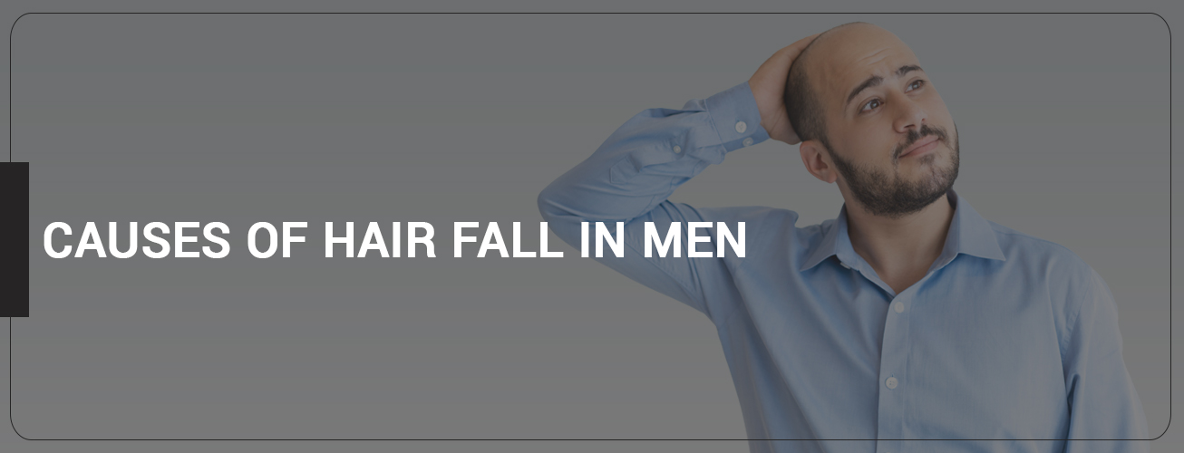 10 Causes of Hair fall in Men 10 Causes of Hair fall in Men