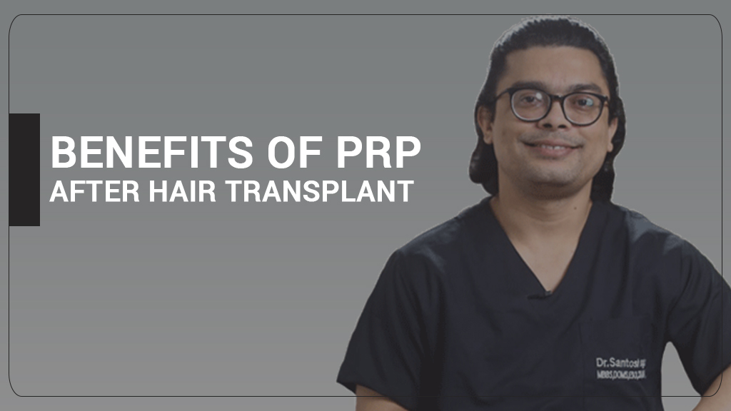 PRP After Hair Transplant