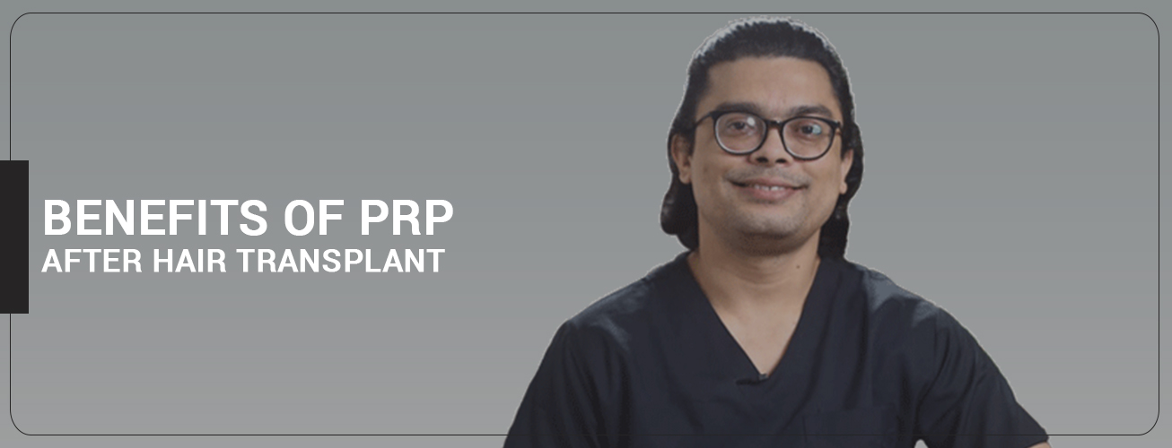 Benefits of PRP After Hair Transplant