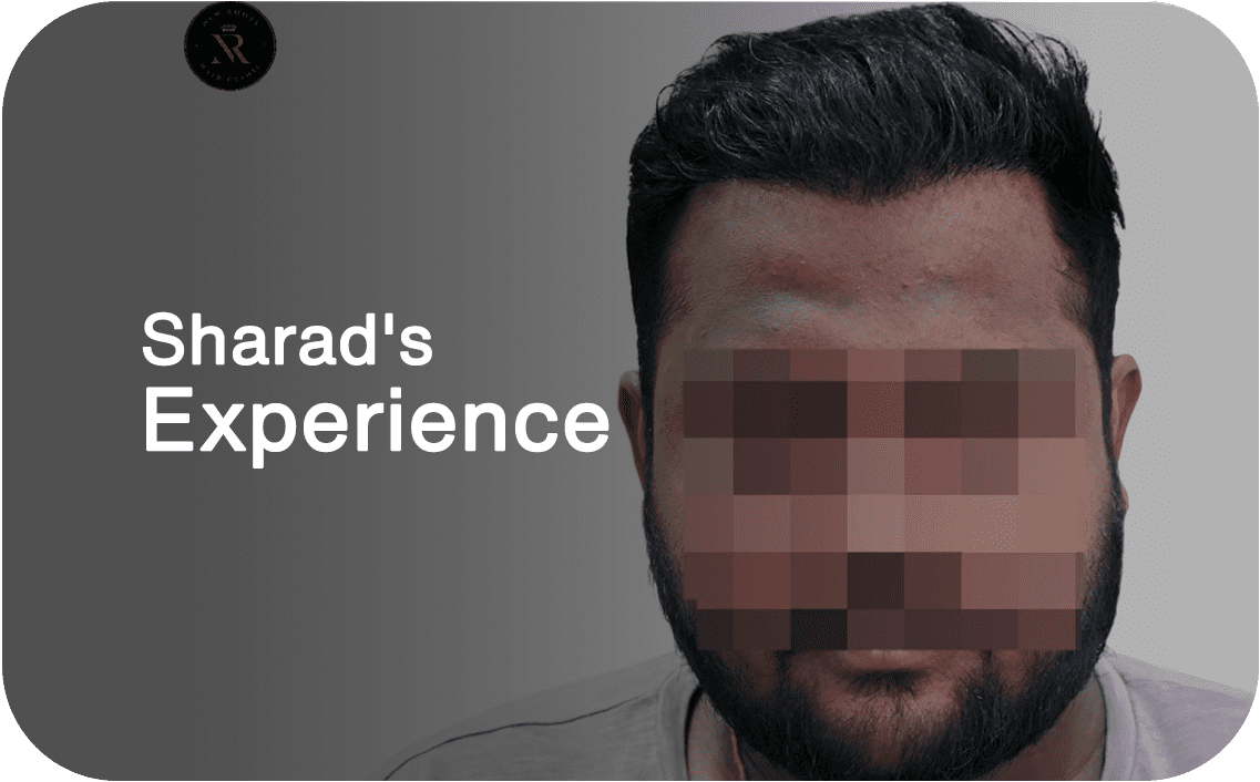 Sharad's Hair Transplant Cost