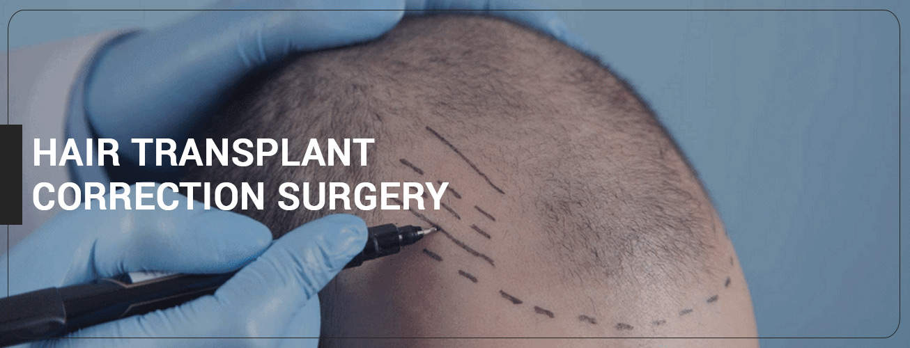 Hair Transplant correction Surgery