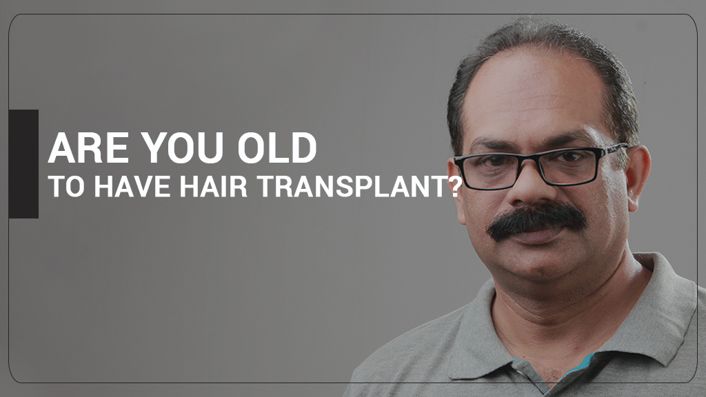 ARE YOU TOO OLD TO HAVE HAIR TRANSPLANT