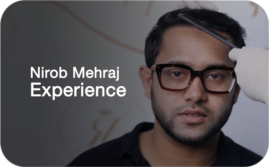 Nirob Mehraj's Hair Transplant Experience