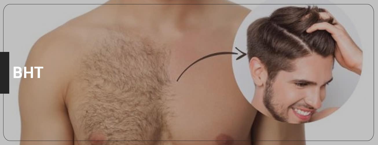 Body Hair Transplant