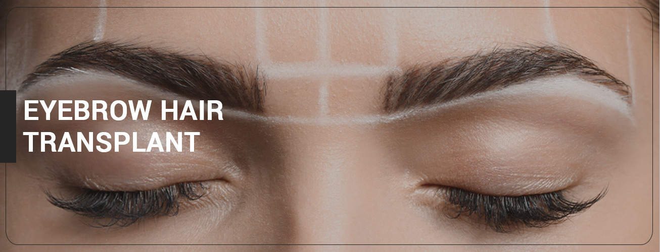 Eyebrow Hair Transplant