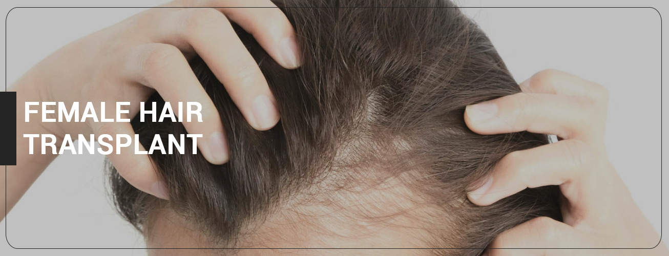 Female Hair Transplant